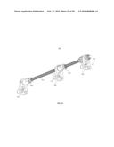 BONE TRANSPORT EXTERNAL FIXATION FRAME diagram and image