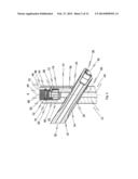 IMPLANT SYSTEM FOR BONE FIXATION diagram and image