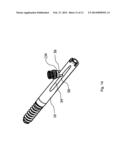 IMPLANT SYSTEM FOR BONE FIXATION diagram and image