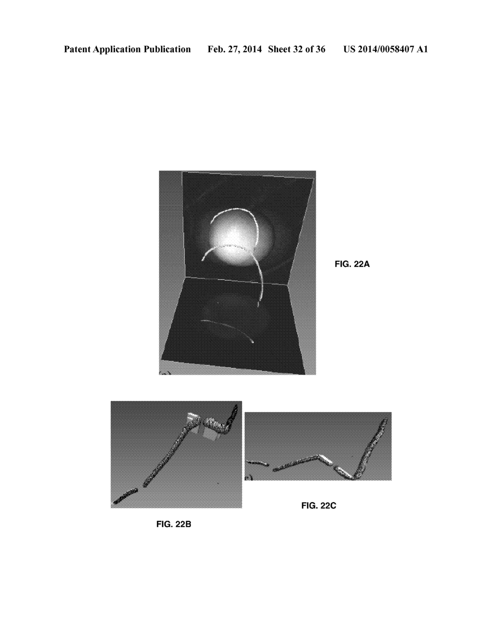 Robotic Device and System Software, Hardware and Methods of Use for     Image-Guided and Robot-Assisted Surgery - diagram, schematic, and image 33