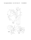 METHOD FOR ROBOTIC ARTHROPLASTY USING NAVIGATION diagram and image