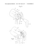 METHOD FOR ROBOTIC ARTHROPLASTY USING NAVIGATION diagram and image