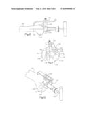 METHOD FOR ROBOTIC ARTHROPLASTY USING NAVIGATION diagram and image