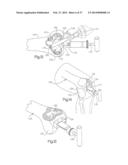 METHOD FOR ROBOTIC ARTHROPLASTY USING NAVIGATION diagram and image