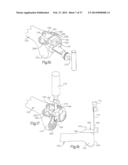 METHOD FOR ROBOTIC ARTHROPLASTY USING NAVIGATION diagram and image