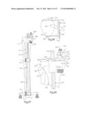 METHOD FOR ROBOTIC ARTHROPLASTY USING NAVIGATION diagram and image