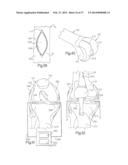 METHOD FOR ROBOTIC ARTHROPLASTY USING NAVIGATION diagram and image