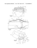 METHOD FOR ROBOTIC ARTHROPLASTY USING NAVIGATION diagram and image