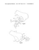 METHOD FOR ROBOTIC ARTHROPLASTY USING NAVIGATION diagram and image