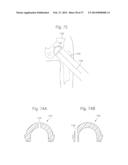 METHOD FOR ROBOTIC ARTHROPLASTY USING NAVIGATION diagram and image