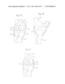 METHOD FOR ROBOTIC ARTHROPLASTY USING NAVIGATION diagram and image