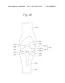 METHOD FOR ROBOTIC ARTHROPLASTY USING NAVIGATION diagram and image