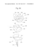 METHOD FOR ROBOTIC ARTHROPLASTY USING NAVIGATION diagram and image