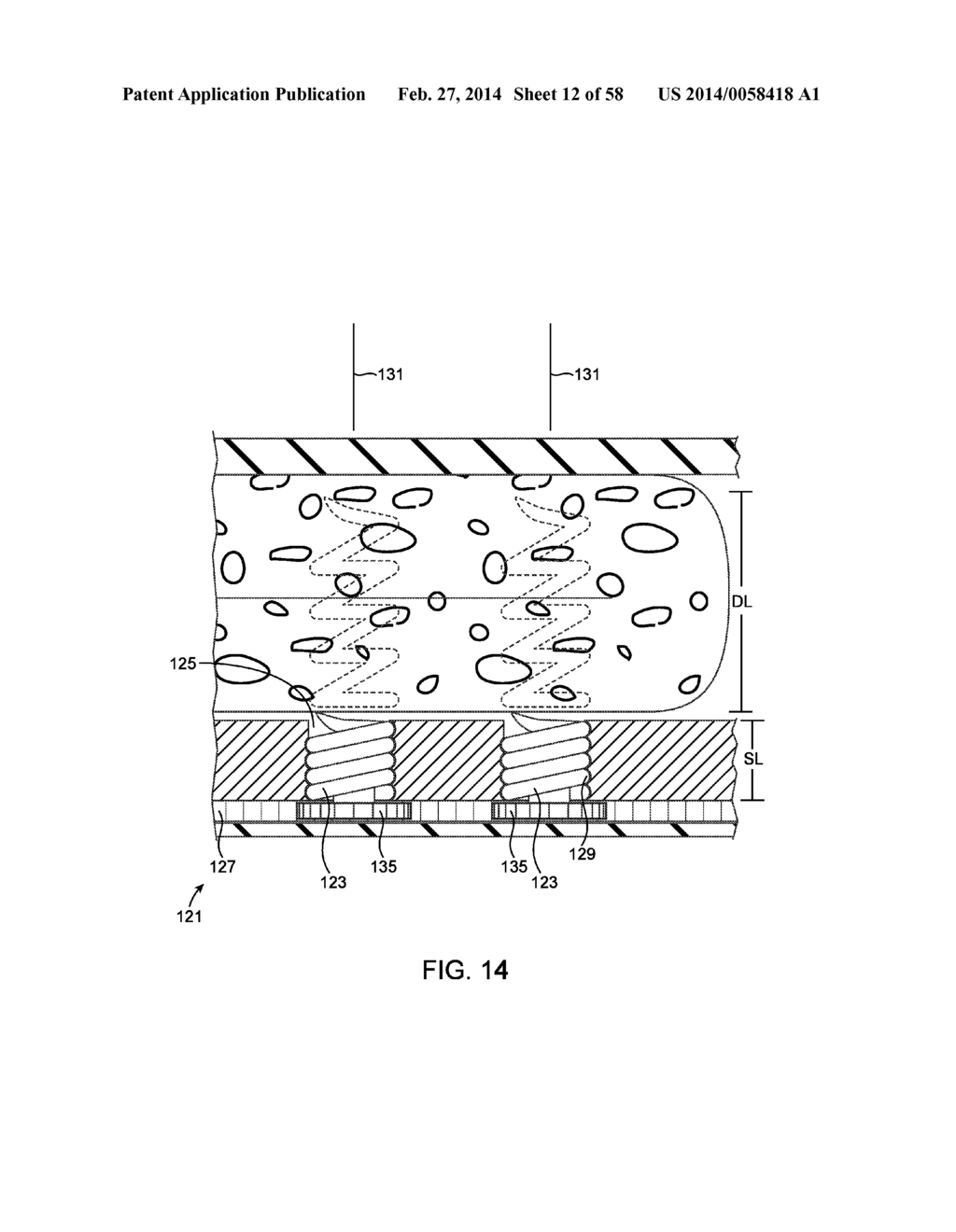 METHODS AND DEVICES FOR MANIPULATING AND FASTENING TISSUE - diagram, schematic, and image 13