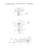 IMPLANT, ESPECIALLY FOR THE OCCLUSION OF BIFURCATION ANEURYSMS diagram and image