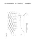 IMPLANT, ESPECIALLY FOR THE OCCLUSION OF BIFURCATION ANEURYSMS diagram and image