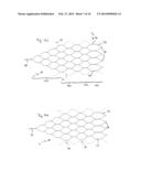 IMPLANT, ESPECIALLY FOR THE OCCLUSION OF BIFURCATION ANEURYSMS diagram and image