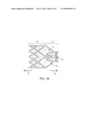 BRONCHIAL ISOLATION DEVICES FOR PLACEMENT IN SHORT LUMENS diagram and image