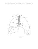 BRONCHIAL ISOLATION DEVICES FOR PLACEMENT IN SHORT LUMENS diagram and image