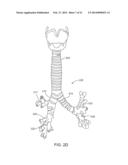 BRONCHIAL ISOLATION DEVICES FOR PLACEMENT IN SHORT LUMENS diagram and image