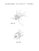 BRONCHIAL ISOLATION DEVICES FOR PLACEMENT IN SHORT LUMENS diagram and image