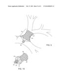 BRONCHIAL ISOLATION DEVICES FOR PLACEMENT IN SHORT LUMENS diagram and image