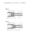 IMPLANT DELIVERY AND RELEASE SYSTEM diagram and image