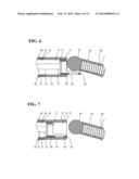 IMPLANT DELIVERY AND RELEASE SYSTEM diagram and image