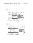 IMPLANT DELIVERY AND RELEASE SYSTEM diagram and image