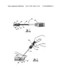 CARRIER TUBES FOR CLOSURE DEVICES diagram and image