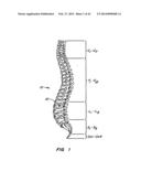 Minimally Invasive Spine Restoration Systems, Devices, Methods and Kits diagram and image