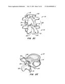 Minimally Invasive Spine Restoration Systems, Devices, Methods and Kits diagram and image