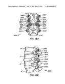 Minimally Invasive Spine Restoration Systems, Devices, Methods and Kits diagram and image