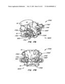 Minimally Invasive Spine Restoration Systems, Devices, Methods and Kits diagram and image