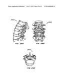 Minimally Invasive Spine Restoration Systems, Devices, Methods and Kits diagram and image