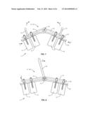 SPINAL CORRECTION SYSTEM AND METHOD diagram and image