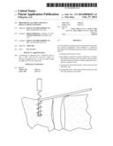 Prosthetic Ligament Having a Helical Bone Fastener diagram and image