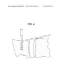 Prosthetic Ligament Having a Helical Bone Fastener diagram and image