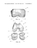 SURGICAL GUIDING TOOLS AND SYSTEMS AND METHODS OF MANUFACTURING SURGICAL     GUIDING TOOLS diagram and image