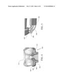 SURGICAL GUIDING TOOLS AND SYSTEMS AND METHODS OF MANUFACTURING SURGICAL     GUIDING TOOLS diagram and image