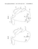 PATIENT COMFORT APPARATUS AND SYSTEM diagram and image