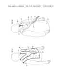 PATIENT COMFORT APPARATUS AND SYSTEM diagram and image