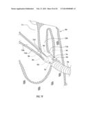 PATIENT COMFORT APPARATUS AND SYSTEM diagram and image