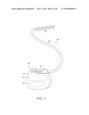 ELECTRICAL STIMULATION LEAD WITH JUNCTION AND METHODS OF MAKING AND USING diagram and image