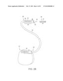 ELECTRICAL STIMULATION LEAD WITH JUNCTION AND METHODS OF MAKING AND USING diagram and image