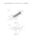 ELECTRICAL STIMULATION LEAD WITH JUNCTION AND METHODS OF MAKING AND USING diagram and image