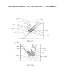 ELECTRICAL STIMULATION LEAD WITH JUNCTION AND METHODS OF MAKING AND USING diagram and image