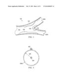 Deployment of Stents within Bifurcated Vessels diagram and image