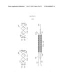 Deployment of Stents within Bifurcated Vessels diagram and image