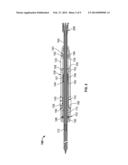 ADJUSTABLE ANNULOPLASTY RING SIZING INDICATOR diagram and image